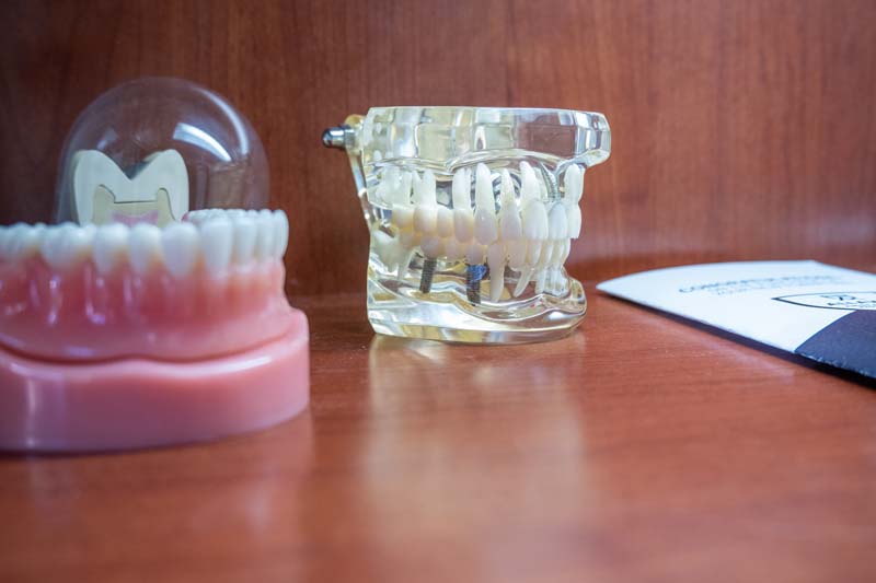 dental implants Caldwell, ID